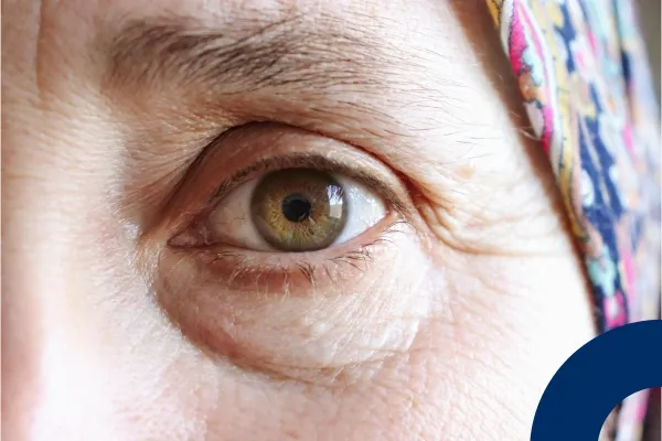 Aging In Eyes