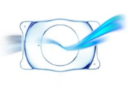 PHAKIC Intraocular Lens – Types of Phakic IOL