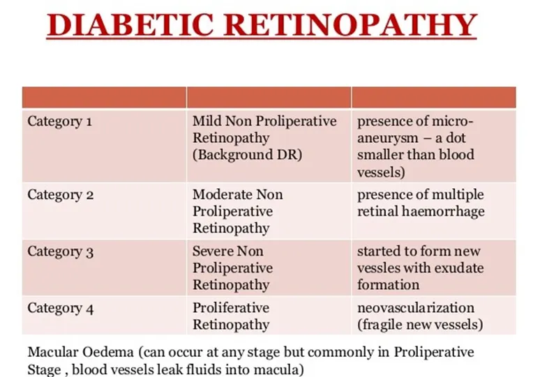 Systemic Diseases & Eye – DM & EYE